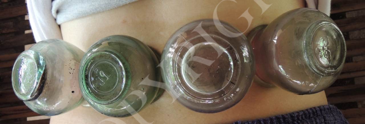 media-cupping